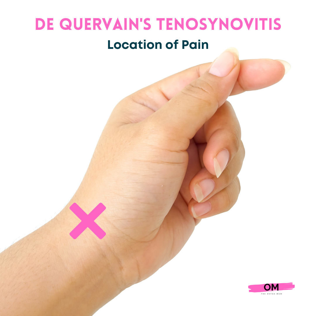 The Best De Quervain's Tenosynovitis Brace - The Osteo Mum